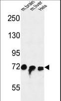 FAM40A Antibody - FAM40A Antibody western blot of mouse brain,liver tissue and HeLa cell line lysates (35 ug/lane). The FAM40A antibody detected the FAM40A protein (arrow).