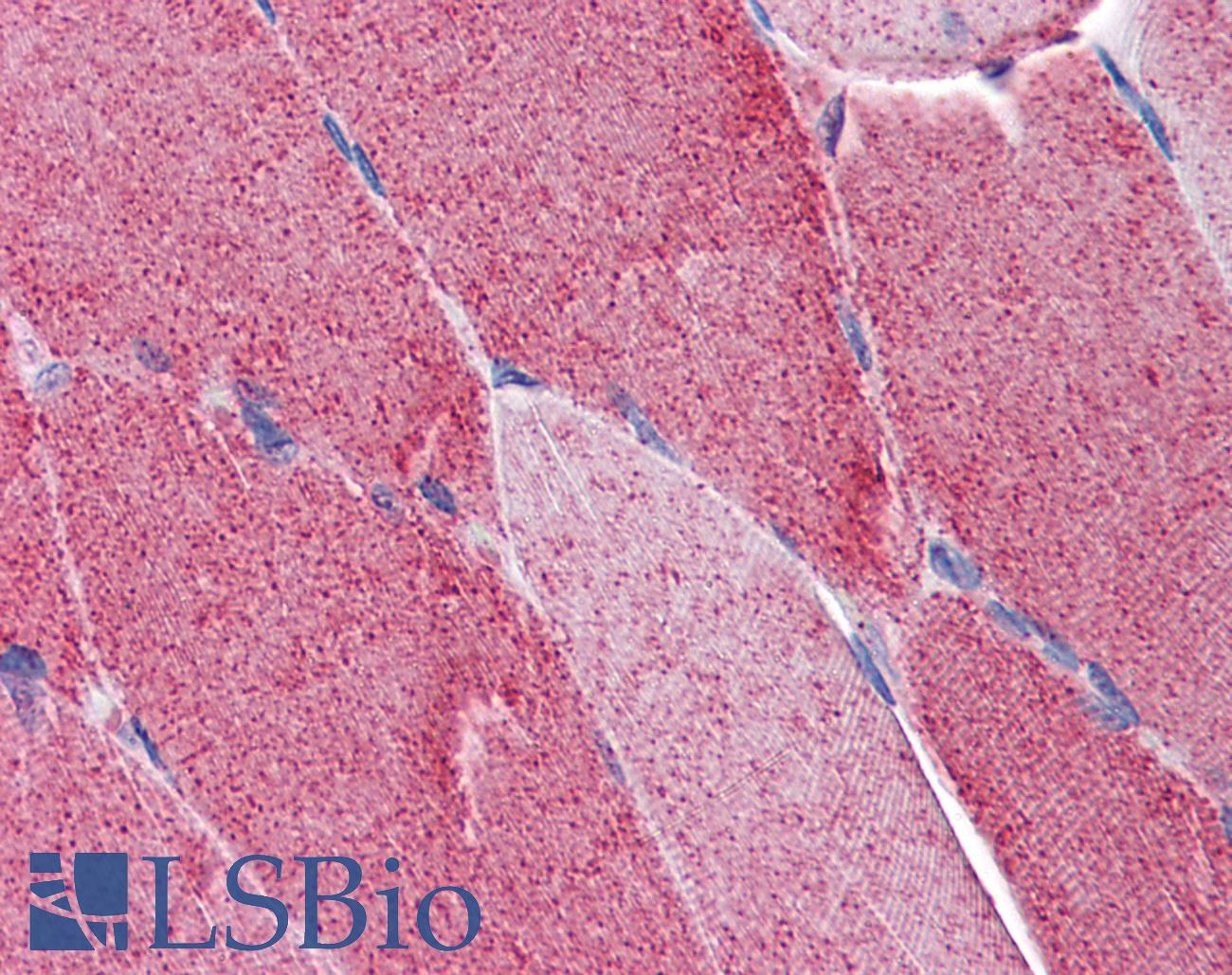 FAM50A Antibody - Anti-FAM50A antibody IHC of human skeletal muscle. Immunohistochemistry of formalin-fixed, paraffin-embedded tissue after heat-induced antigen retrieval. Antibody concentration 5 ug/ml.