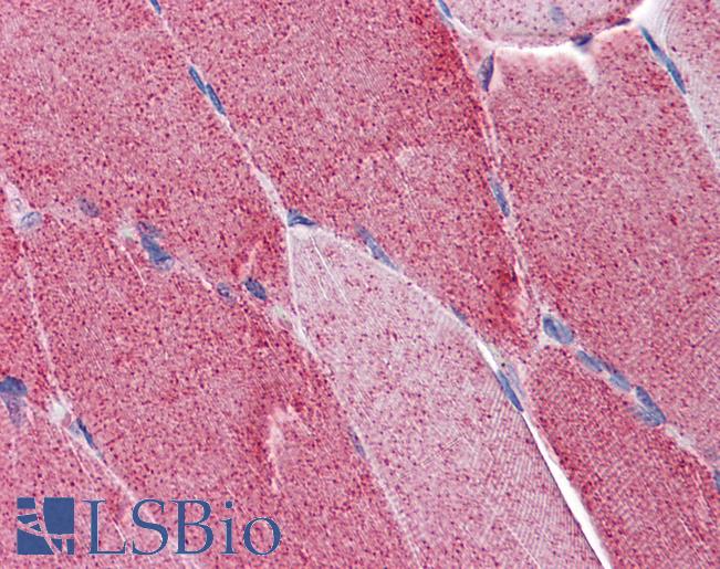 FAM50A Antibody - Anti-FAM50A antibody IHC of human skeletal muscle. Immunohistochemistry of formalin-fixed, paraffin-embedded tissue after heat-induced antigen retrieval. Antibody concentration 5 ug/ml.