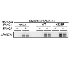 FANCA Antibody - Anti-FANCA Antibody - Western Blot. Western blot of affinity purified anti-FANCA antibody shows detection of FANCA only in FANCA transfected GM6914 cell lysates. No staining is seen in lysates prepared from FANCA (-/-) cells in the absence of FANCA transfection. Modified from Smogorzewska et al (2007) Cell 129, 289-301.