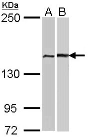 FANCA Antibody - Sample (30 ug of whole cell lysate). A: A431 , B: Hela. 12% SDS PAGE. FANCA antibody diluted at 1:1000.