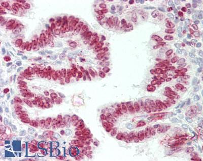 FANCA Antibody - Human Uterus: Formalin-Fixed, Paraffin-Embedded (FFPE)