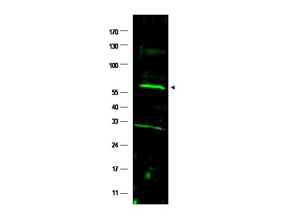 FANCC Antibody - Anti-FANCC Antibody - Western Blot. Western blot of affinity purified anti-FANCC antibody shows detection of a band at ~63 kD (arrowhead) corresponding to FANCC present in a HeLa whole cell lysate. The identity of the lower molecular weight band is unknown. Approximately 35 ug of lysate was separated by 4-20% Tris Glycine SDS-PAGE. After blocking, the membrane was probed overnight at 4C with the primary antibody diluted to 1:1500 in PBS supplemented with 1% normal goat serum and 0.1% BLOTTO (B501-0500). The membrane was washed and reacted with a 1:10000 dilution of IRDye800 conjugated Gt-a-Rabbit IgG [H&L] ( for 45 min at room temperature (800 nm channel, green). Molecular weight estimation was made by comparison to prestained MW markers (indicated at left). IRDye800 fluorescence image was captured using the Odyssey Infrared Imaging System developed by LI-COR. IRDye is a trademark of LI-COR, Inc. Other detection systems will yield similar results.