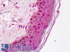 FANCD2 Antibody - Anti-FANCD2 antibody IHC of human skin. Immunohistochemistry of formalin-fixed, paraffin-embedded tissue after heat-induced antigen retrieval. Antibody dilution 1:500.