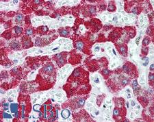 FANCD2 Antibody - Anti-FANCD2 antibody IHC of human liver. Immunohistochemistry of formalin-fixed, paraffin-embedded tissue after heat-induced antigen retrieval. Antibody concentration 5 ug/ml.