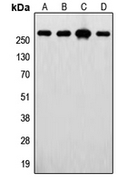 FASN / Fatty Acid Synthase Antibody - Western blot analysis of FASN expression in MCF7 (A); U2OS (B); SKBR3 (C); HepG2 (D) whole cell lysates.
