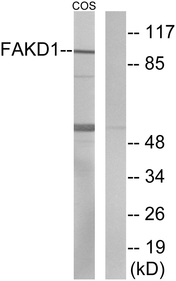 FASTKD1 Antibody - Western blot analysis of lysates from COS7 cells, using FAKD1 Antibody. The lane on the right is blocked with the synthesized peptide.