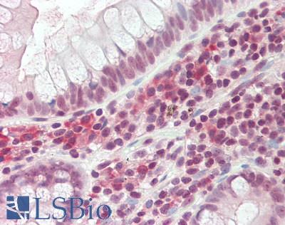 FBL / FIB / Fibrillarin Antibody - Human Small Intestine: Formalin-Fixed, Paraffin-Embedded (FFPE)
