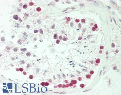 FBL / FIB / Fibrillarin Antibody - Human Testis: Formalin-Fixed, Paraffin-Embedded (FFPE)