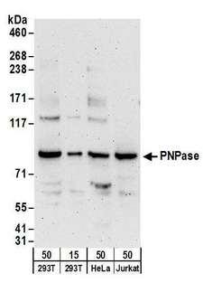 FBL / FIB / Fibrillarin Antibody - Detection of human PNPase by western blot. Samples: Whole cell lysate from HEK293T (15 and 50 µg), HeLa (50µg), and Jurkat (50µg) cells. Antibodies: Affinity purified rabbit anti-PNPase antibody used for WB at 0.4 µg/ml. Detection: Chemiluminescence with an exposure time of 3 minutes.