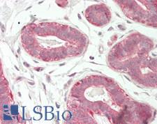 FBLIM1 / Migfilin Antibody - Human Breast: Formalin-Fixed, Paraffin-Embedded (FFPE)