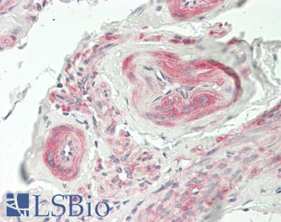 FBLIM1 / Migfilin Antibody - Human Uterus, Myometrium: Formalin-Fixed, Paraffin-Embedded (FFPE)