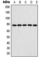 FBLN1 / Fibulin 1 Antibody - Western blot analysis of Fibulin 1 expression in A431 (A); A549 (B); HeLa (C); NIH3T3 (D); H9C2 (E) whole cell lysates.