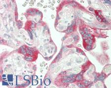 FBLN1 / Fibulin 1 Antibody - Human Placenta: Formalin-Fixed, Paraffin-Embedded (FFPE)