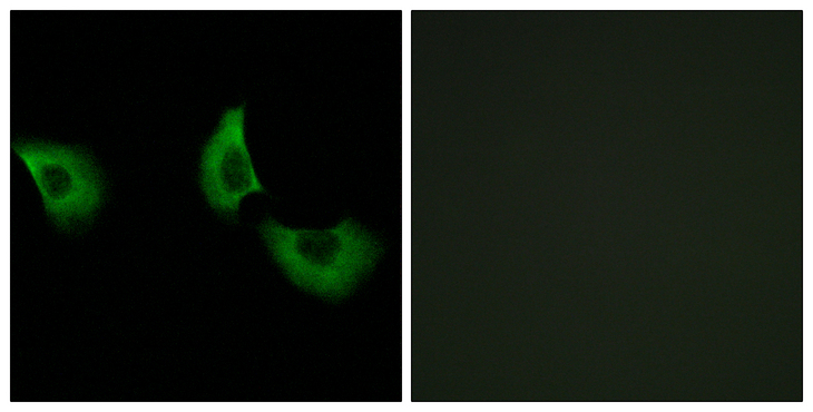 FBLN4 / EFEMP2 Antibody - Immunofluorescence analysis of A549 cells, using EFEMP2 Antibody. The picture on the right is blocked with the synthesized peptide.