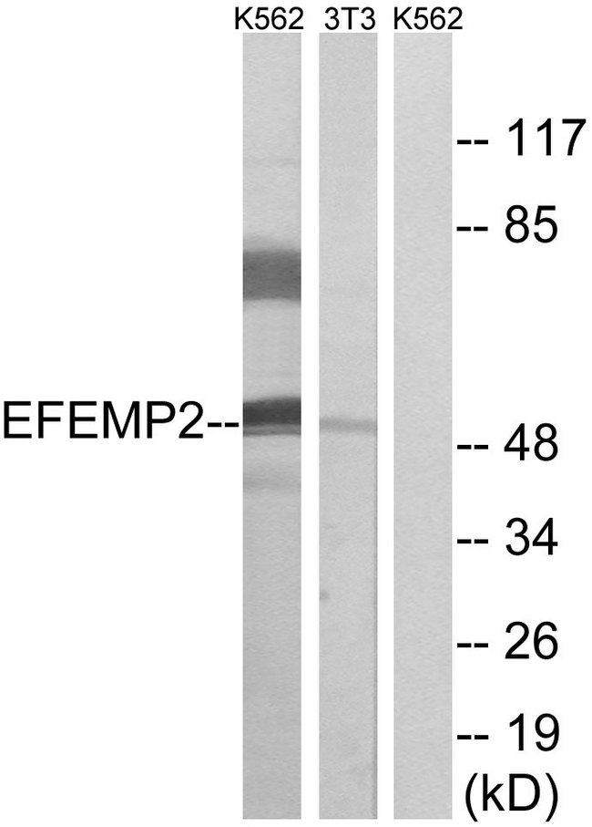 FBLN4 / EFEMP2 Antibody - Western blot analysis of lysates from K562 and NIH/3T3 cells, using EFEMP2 Antibody. The lane on the right is blocked with the synthesized peptide.