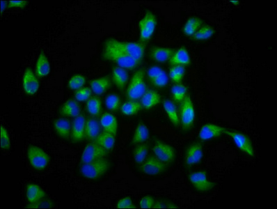 FBP / FOLR2 Antibody - Immunofluorescence staining of Hela cells diluted at 1:133, counter-stained with DAPI. The cells were fixed in 4% formaldehyde, permeabilized using 0.2% Triton X-100 and blocked in 10% normal Goat Serum. The cells were then incubated with the antibody overnight at 4°C.The Secondary antibody was Alexa Fluor 488-congugated AffiniPure Goat Anti-Rabbit IgG (H+L).