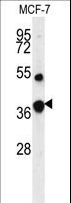 FBP1 Antibody - Western blot of FBP1 Antibody in MCF-7 cell line lysates (35 ug/lane). FBP1 (arrow) was detected using the purified antibody.
