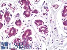 FBXL13 Antibody - Human Breast: Formalin-Fixed, Paraffin-Embedded (FFPE)