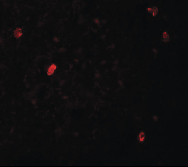 FBXL16 Antibody - Immunofluorescence of FBXL16 in human spleen tissue with FBXL16 antibody at 20 ug/ml.