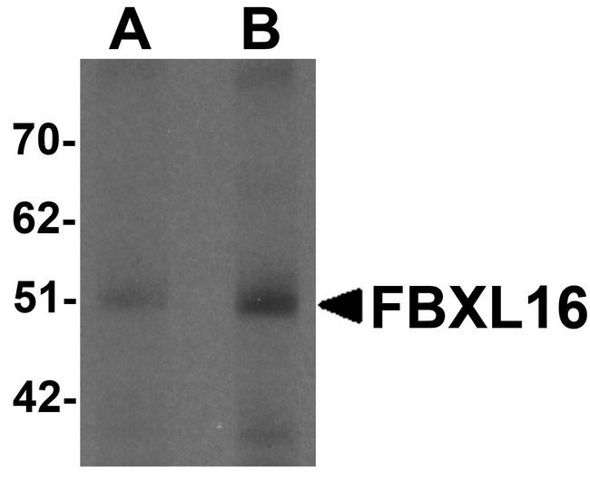 FBXL16 Antibody - Western blot analysis of FBXL16 in human spleen tissue lysate with FBXL16 antibody at (A) 0.5 and (B) 1 ug/ml.