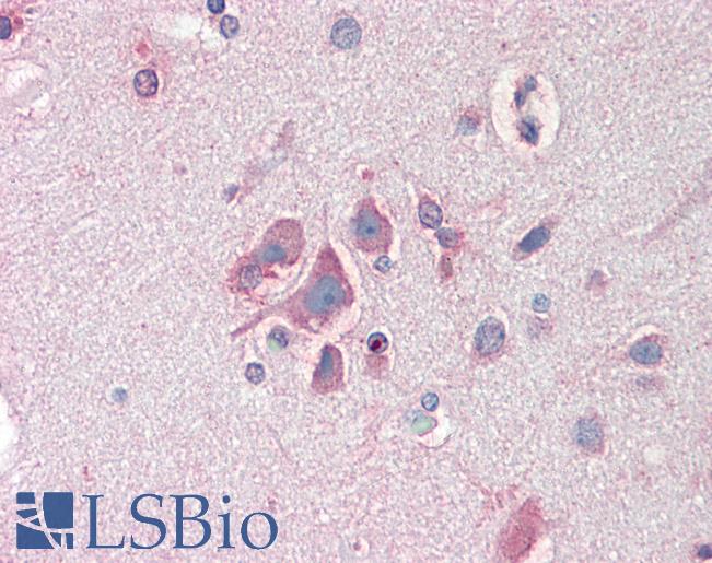 FBXL2 Antibody - Anti-FBXL2 antibody IHC staining of human brain, cortex. Immunohistochemistry of formalin-fixed, paraffin-embedded tissue after heat-induced antigen retrieval. Antibody concentration 10 ug/ml.