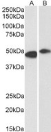 FBXL2 Antibody - Goat Anti-FBL2 / FBXL2 Antibody (0.3µg/ml) staining of Human Frontal Cortex (A) and Rat (B) Brain lysate (35µg protein in RIPA buffer). Detected by chemiluminescencence