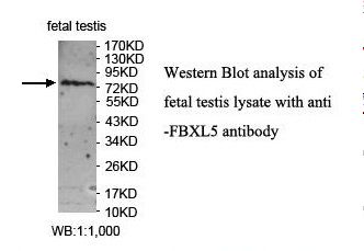 FBXL5 / FBL5 Antibody