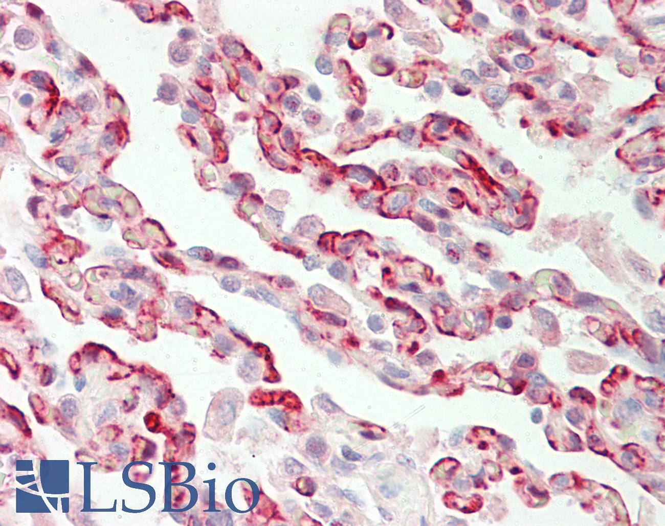 FBXL5 / FBL5 Antibody - Anti-FBXL5 / FBL5 antibody IHC staining of human lung. Immunohistochemistry of formalin-fixed, paraffin-embedded tissue after heat-induced antigen retrieval. Antibody concentration 10 ug/ml.
