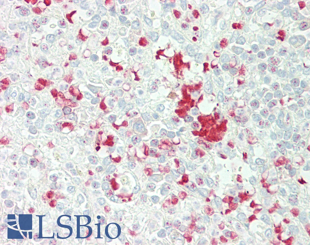 FBXL5 / FBL5 Antibody - Anti-FBXL5 / FBL5 antibody IHC staining of human spleen. Immunohistochemistry of formalin-fixed, paraffin-embedded tissue after heat-induced antigen retrieval.