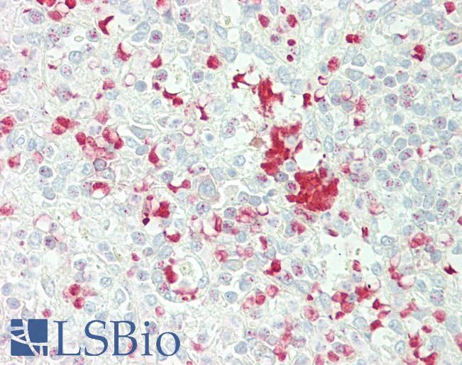 FBXL5 / FBL5 Antibody - Anti-FBXL5 / FBL5 antibody IHC staining of human spleen. Immunohistochemistry of formalin-fixed, paraffin-embedded tissue after heat-induced antigen retrieval.
