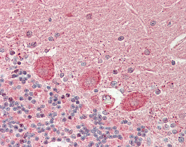 FBXO39 Antibody - Human Brain, Cerebellum: Formalin-Fixed, Paraffin-Embedded (FFPE)
