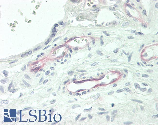 FCAR / CD89 Antibody - Human Placenta: Formalin-Fixed, Paraffin-Embedded (FFPE)
