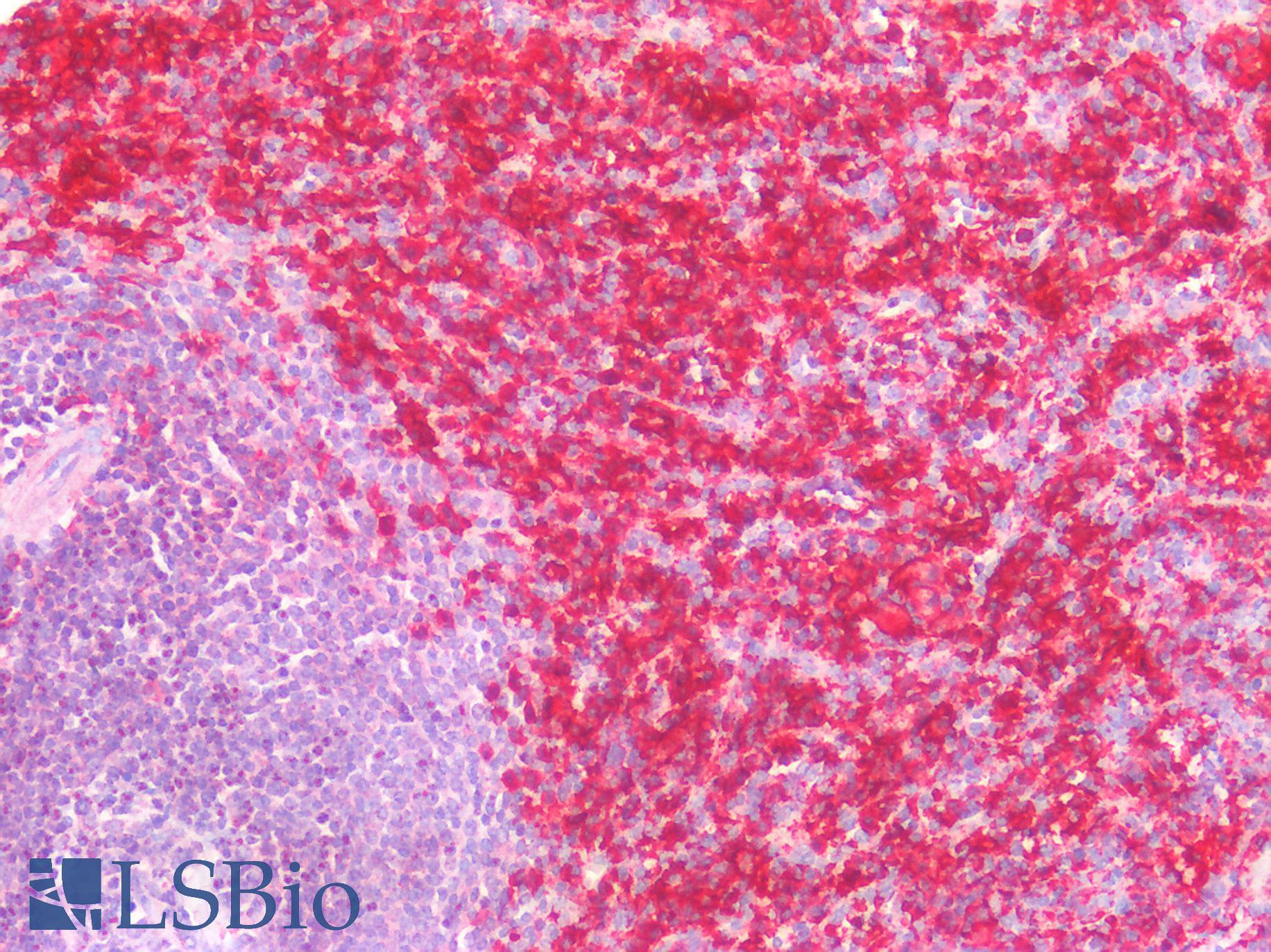 FCER1G Antibody - Human Spleen: Formalin-Fixed, Paraffin-Embedded (FFPE)