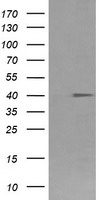 FCGR1A / CD64 Antibody - HEK293T cells were transfected with the pCMV6-ENTRY control (Left lane) or pCMV6-ENTRY FCGR1A (Right lane) cDNA for 48 hrs and lysed. Equivalent amounts of cell lysates (5 ug per lane) were separated by SDS-PAGE and immunoblotted with anti-FCGR1A.