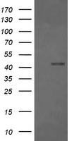 FCGR1A / CD64 Antibody - HEK293T cells were transfected with the pCMV6-ENTRY control (Left lane) or pCMV6-ENTRY FCGR1A (Right lane) cDNA for 48 hrs and lysed. Equivalent amounts of cell lysates (5 ug per lane) were separated by SDS-PAGE and immunoblotted with anti-FCGR1A.