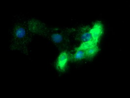 FCGR1A / CD64 Antibody - Anti-FCGR1A mouse monoclonal antibody immunofluorescent staining of COS7 cells transiently transfected by pCMV6-ENTRY FCGR1A.