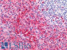 FCGR3B / CD16B Antibody - Human Spleen: Formalin-Fixed, Paraffin-Embedded (FFPE)