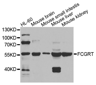 FCGRT / FCRN Antibody - Western blot analysis of extracts of various cells.