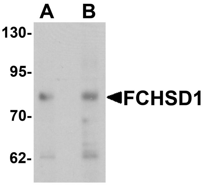 FCHSD1 Antibody - Western blot analysis of FCHSD1 in MCF7 cell lysate with FCHSD1 antibody at (A) 0.5 and (B)1 ug/ml.