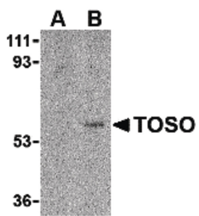 FCMR / FAIM3 Antibody - Western blot of Toso in human lung tissue lysate with Toso antibody at 1 ug/ml in either the (A) presence, or (B) absence of blocking peptide.