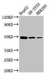 FDFT1 / Squalene Synthase Antibody - Western Blot Positive WB detected in: HepG2 whole cell lysate, SH-SY5Y whole cell lysate, HEK293 whole cell lysate All lanes: FDFT1 antibody at 3µg/ml Secondary Goat polyclonal to rabbit IgG at 1/50000 dilution Predicted band size: 49, 41, 39, 36, 44 kDa Observed band size: 49 kDa