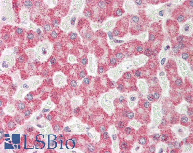 FDXR Antibody - Human Liver: Formalin-Fixed, Paraffin-Embedded (FFPE).  This image was taken for the unconjugated form of this product. Other forms have not been tested.