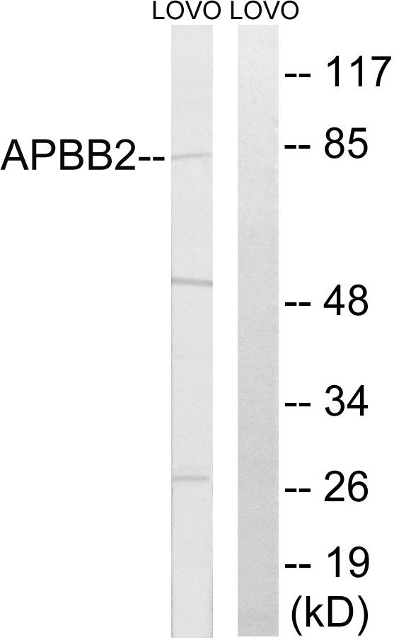 FE65L1 / APBB2 Antibody - Western blot analysis of lysates from LOVO cells, using APBB2 Antibody. The lane on the right is blocked with the synthesized peptide.