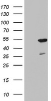 FEN1 Antibody - HEK293T cells were transfected with the pCMV6-ENTRY control (Left lane) or pCMV6-ENTRY FEN1 (Right lane) cDNA for 48 hrs and lysed. Equivalent amounts of cell lysates (5 ug per lane) were separated by SDS-PAGE and immunoblotted with anti-FEN1.
