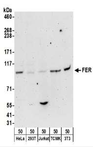 FER Antibody - Detection of Human and Mouse FER by Western Blot. Samples: Whole cell lysate (50 ug) from HeLa, 293T, Jurkat, mouse TCMK-1, and mouse NIH3T3 cells. Antibodies: Affinity purified rabbit anti-FER antibody used for WB at 0.1 ug/ml. Detection: Chemiluminescence with an exposure time of 3 minutes.