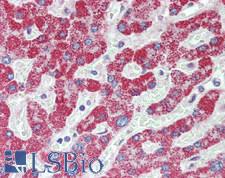 FER Antibody - Human Liver: Formalin-Fixed, Paraffin-Embedded (FFPE)