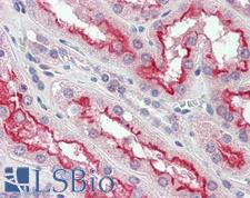 FER Antibody - Anti-FER antibody IHC of human kidney. Immunohistochemistry of formalin-fixed, paraffin-embedded tissue after heat-induced antigen retrieval. Antibody dilution 1:200.