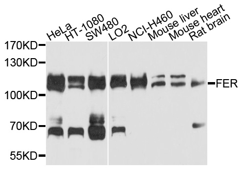FER Antibody - Western blot analysis of extracts of various cells.