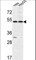 FERMT1 / Kindlin Antibody - FERMT1 Antibody western blot of HeLa,HepG2 cell line lysates (35 ug/lane). The FERMT1 antibody detected the FERMT1 protein (arrow).